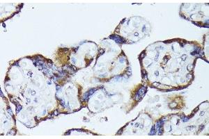 Immunohistochemistry of paraffin-embedded Human placenta using TBCB Polyclonal Antibody at dilution of 1:100 (40x lens).