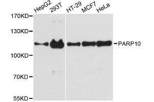 Western blot analysis of extracts of various cell lines, using PARP10 antibody. (PARP10 anticorps  (AA 1-300))