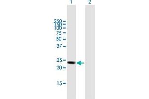 Western Blot analysis of LYPLA1 expression in transfected 293T cell line by LYPLA1 MaxPab polyclonal antibody. (LYPLA1 anticorps  (AA 1-230))