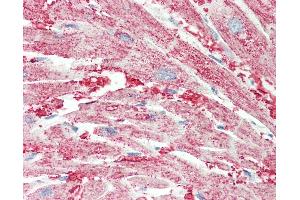 Anti-SLC30A1 antibody IHC staining of human heart.