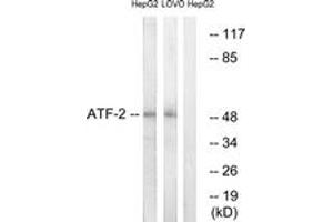 Western blot analysis of extracts from HepG2/LOVO cells, using ATF2 (Ab-69 or 51) Antibody. (ATF2 anticorps  (AA 35-84))