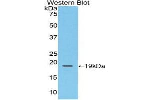 Western blot analysis of the recombinant protein. (CD97 anticorps  (AA 32-173))