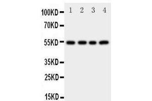 Western Blotting (WB) image for anti-Cystatin A (Stefin A) (CSTA) (AA 77-90), (C-Term) antibody (ABIN3042657) (CSTA anticorps  (C-Term))