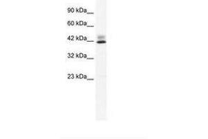 Image no. 2 for anti-Zinc Finger Protein 551 (ZNF551) (AA 169-218) antibody (ABIN203081) (ZNF551 anticorps  (AA 169-218))