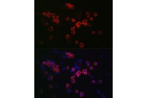 Immunofluorescence analysis of R. (CCR7 anticorps  (AA 1-100))