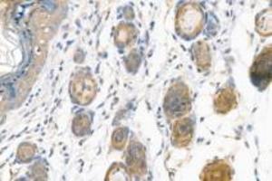Immunohistochemistry analysis of paraffin-embedded mouse skin using,alpha Actinin (ABIN7073023) at dilution of 1: 900 (alpha Actinin anticorps)