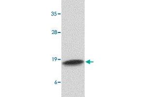 Western blot analysis of CAMP in human spleen tissue lysate with CAMP polyclonal antibody  at 1 ug/mL . (Cathelicidin anticorps  (C-Term))