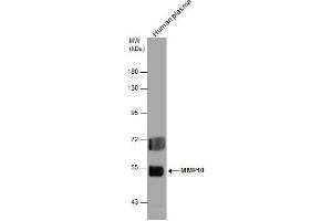 WB Image MMP10 antibody detects MMP10 protein by western blot analysis.