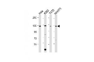 All lanes : Anti-ROR2 Antibody (C-term) at 1:2000 dilution Lane 1: Hela whole cell lysate Lane 2: K562 whole cell lysate Lane 3: T47D whole cell lysate Lane 4: NIH/3T3 whole cell lysate Lysates/proteins at 20 μg per lane.