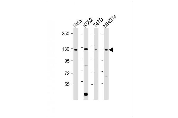 ROR2 anticorps  (C-Term)
