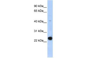 WB Suggested Anti-C16orf80 Antibody Titration:  0. (C16orf80 anticorps  (Middle Region))