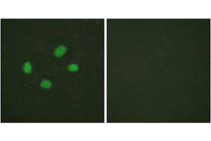 Immunofluorescence analysis of HeLa cells, using Chk2 (Phospho-Thr383) antibody. (CHEK2 anticorps  (pThr383))