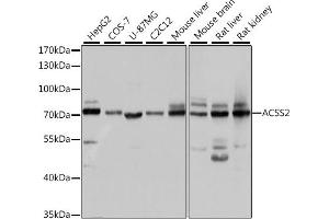 Western blot analysis of extracts of various cell lines, using  antibody (ABIN6131387, ABIN6136467, ABIN6136469 and ABIN6222130) at 1:1000 dilution. (ACSS2 anticorps)