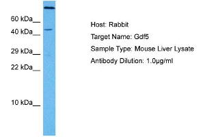 Host: Mouse Target Name: GDF5 Sample Tissue: Mouse Liver Antibody Dilution: 1ug/ml (GDF5 anticorps  (C-Term))