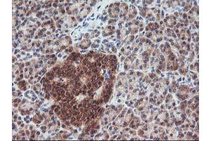 Image no. 3 for anti-Fibroblast Growth Factor 21 (FGF21) (AA 29-209) antibody (ABIN1491337) (FGF21 anticorps  (AA 29-209))
