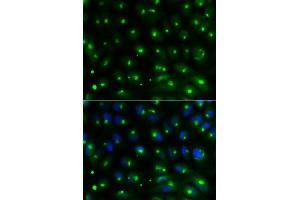 Immunofluorescence analysis of MCF-7 cells using GGA2 antibody (ABIN5970532). (GGA2 anticorps)