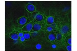 Immunofluorescence of cultured rat neurons and glia showing axonal and dendritic staining of alpha II spectrin (green) revealing the submembranous cytoskeleton and DNA (blue). (SPTAN1 anticorps)