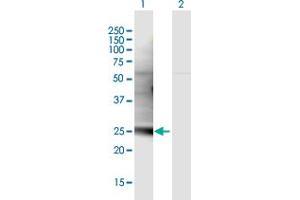 Western Blot analysis of C1QL3 expression in transfected 293T cell line by C1QL3 MaxPab polyclonal antibody.