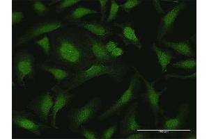 Immunofluorescence of purified MaxPab antibody to CYTH2 on HeLa cell.