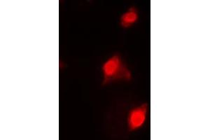 Immunofluorescent analysis of RAD51C staining in HeLa cells. (RAD51C anticorps  (Center))