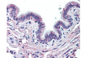 Anti-MUC13 antibody IHC of human lung, respiratory epithelium.