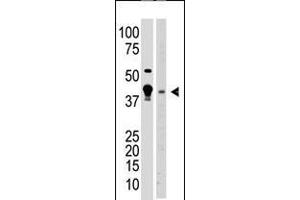 Antibody is used in Western blot to detect MBD2 in A375 cell lysate (lane 1) and mouse brain tissue lysate (lane 2) lysate.