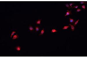 ABIN6269368 staining HeLa cells by IF/ICC.