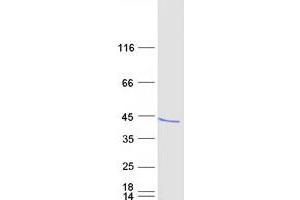 Validation with Western Blot