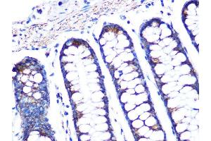 Immunohistochemistry of paraffin-embedded human colon using PBR/TSPORabbit mAb (ABIN1679051, ABIN3019258, ABIN3019259 and ABIN7101738) at dilution of 1:100 (40x lens).