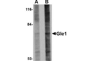 Western Blotting (WB) image for anti-GLE1 RNA Export Mediator (GLE1) (Middle Region) antibody (ABIN1030940) (GLE1 anticorps  (Middle Region))