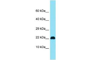 Host: Rabbit Target Name: C15orf32 Sample Type: Jurkat Whole Cell lysates Antibody Dilution: 1. (C15ORF32 anticorps  (N-Term))