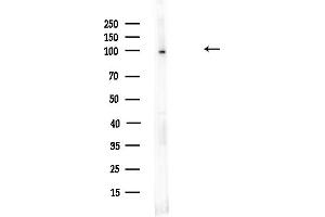 Western blot analysis of lysates from HUVEC cells(UV,30 min treatment), using Insulin degrading enzyme/IDE Antibody at 1/1000 dilution.