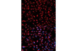 Immunofluorescence analysis of HeLa cell using DOK4 antibody. (DOK4 anticorps  (AA 240-326))