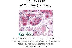 Image no. 2 for anti-Arginine Vasopressin Receptor 1B (AVPR1B) (C-Term) antibody (ABIN1732149) (AVPR1B anticorps  (C-Term))