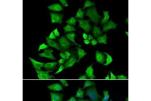 Immunofluorescence analysis of A549 cells using ENTPD2 Polyclonal Antibody (ENTPD2 anticorps)
