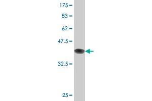 Western Blot detection against Immunogen (36. (DCP1A anticorps  (AA 186-285))