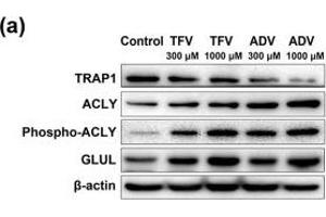 Analysis of glucose and glycogen pathways mediated by TFV and ADV treatment in HK-2 cells. (TRAP1 anticorps)