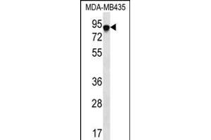 FYB Antibody (C-term) (ABIN656241 and ABIN2845557) western blot analysis in MDA-M cell line lysates (35 μg/lane). (FYB anticorps  (C-Term))