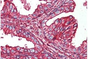 Human Prostate (formalin-fixed, paraffin-embedded) stained with HSPB6 antibody ABIN364293 at 2.