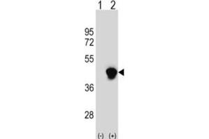Western Blotting (WB) image for anti-Enoyl-CoA Delta Isomerase 2 (PECI) antibody (ABIN3003871)