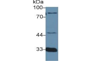 Mouse Capture antibody from the kit in WB with Positive Control: Human urine. (Prothrombin Fragment 1+2 Kit ELISA)