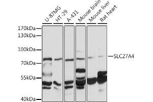 Western blot analysis of extracts of various cell lines, using F/SLC27 antibody (ABIN7270445) at 1:1000 dilution. (SLC27A4 anticorps  (AA 574-643))