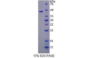 SDS-PAGE (SDS) image for Calpain 5 (CAPN5) (AA 26-343) protein (His tag) (ABIN6239214)