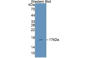 Western blot analysis of the recombinant protein. (NCR3 anticorps  (AA 21-147))