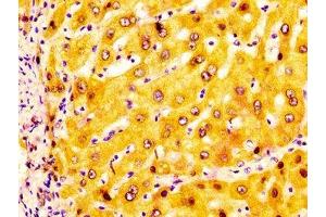 IHC image of ABIN7143641 diluted at 1:200 and staining in paraffin-embedded human liver tissue performed on a Leica BondTM system.