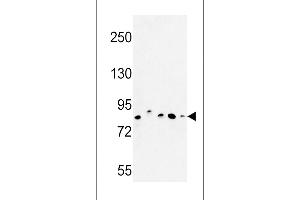 Western blot analysis of CHPF Antibody in MDA-MB435, MCF-7, HepG2, A375 cell line and mouse testis tissue lysates (35ug/lane) (CHPF anticorps  (AA 327-354))