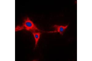 Immunofluorescent analysis of Cytochrome P450 2A13 staining in HepG2 cells.
