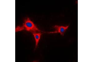 Immunofluorescent analysis of Cytochrome P450 2A13 staining in HepG2 cells.