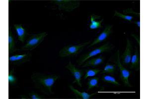 Immunofluorescence of purified MaxPab antibody to KLK7 on HeLa cell.