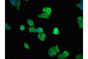 Immunofluorescent analysis of HepG2 cells using ABIN7174413 at dilution of 1:100 and Alexa Fluor 488-congugated AffiniPure Goat Anti-Rabbit IgG(H+L)
